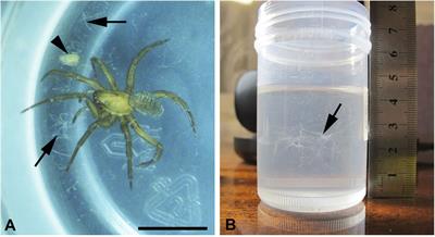 Ultrastructure of silk threads of the water spider Argyroneta aquatica (Clerck, 1757) (Araneae, Cybeidae) in comparison with that of some mites